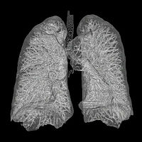 Imagen de los pulmones obtenida mediante ecografía.